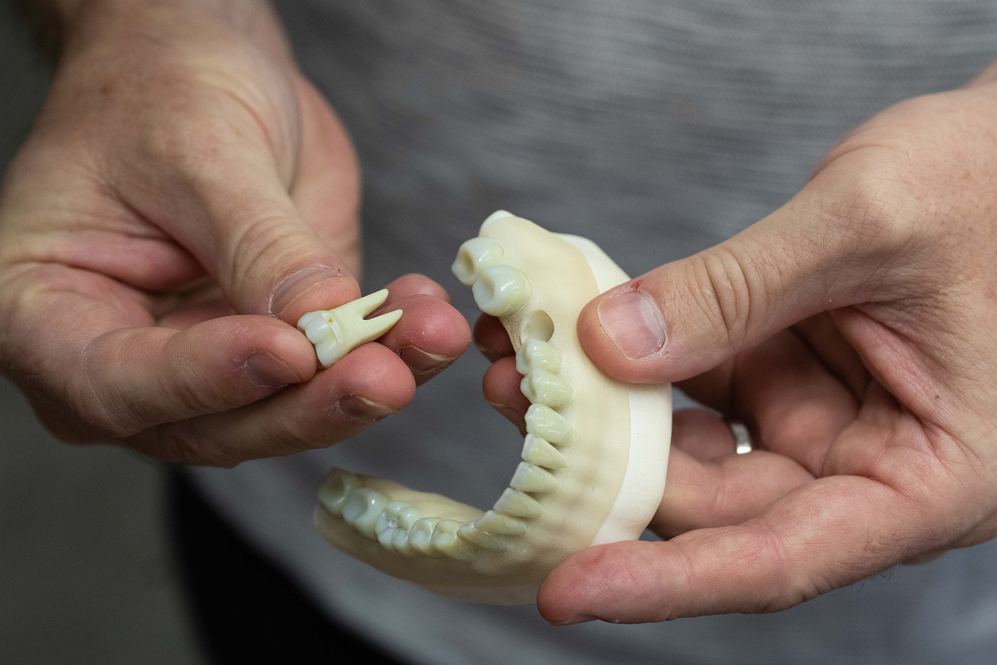 simulated teeth created by Protostudios at the University of Iowa