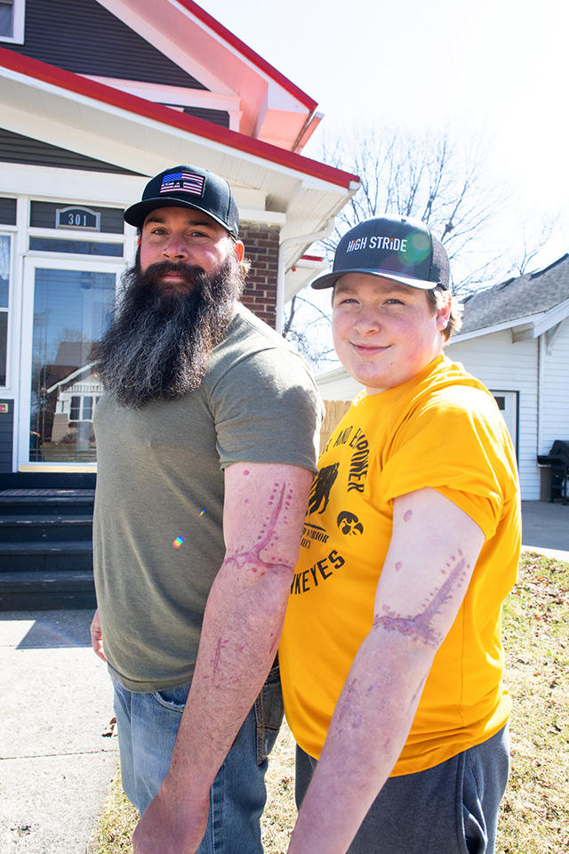 A man with a tattoo in the shape of a scar standing next to a boy with a scar