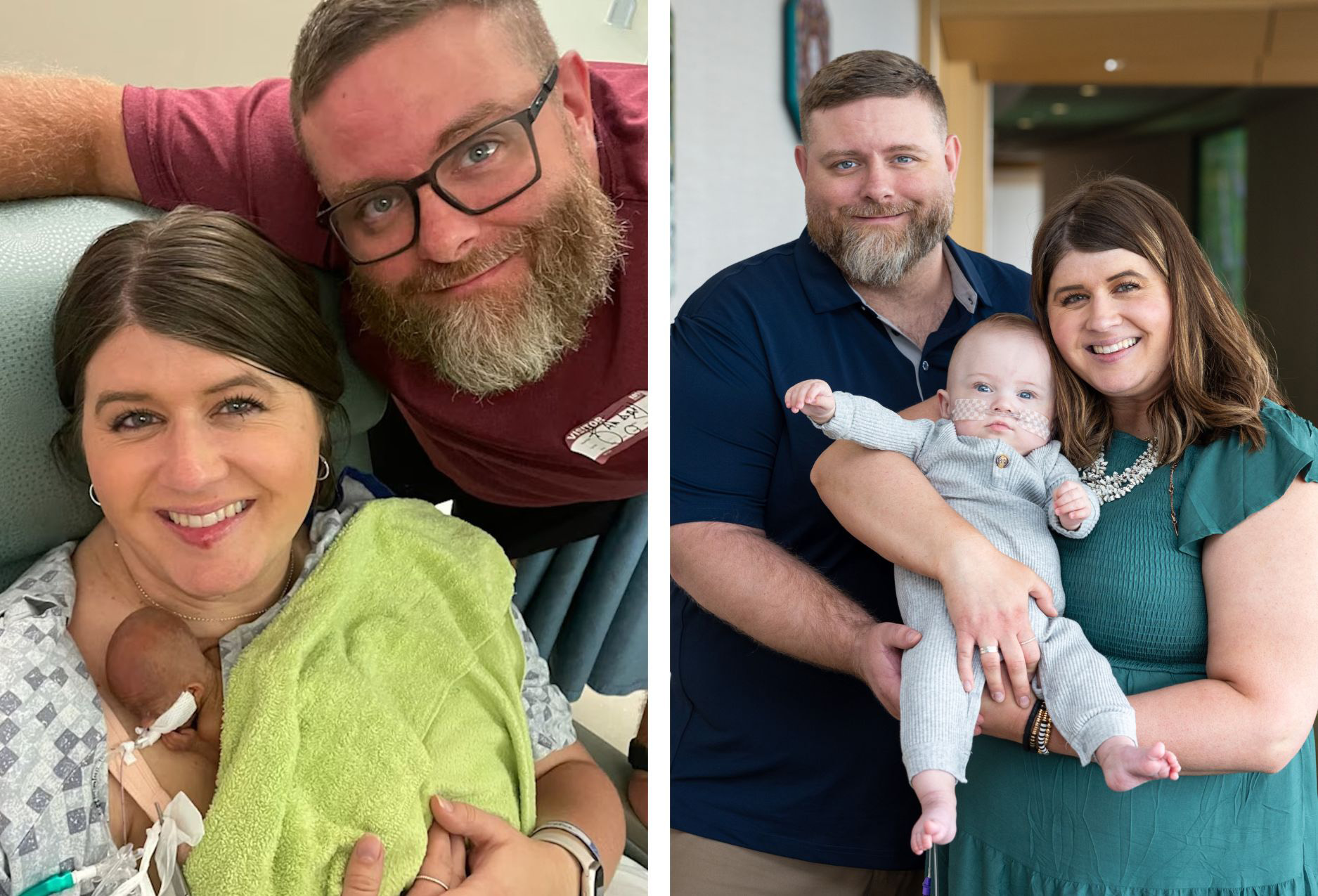 a side-by-side shot that shows the Keen family shortly after Nash was born (133 days premature) and a shot of the parents holding Nash at 1 year old