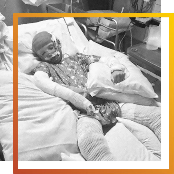 a boy with severe injuries lying in a hospital bed