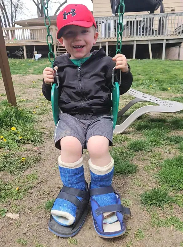 a young boy wearing leg casts sits on a swing
