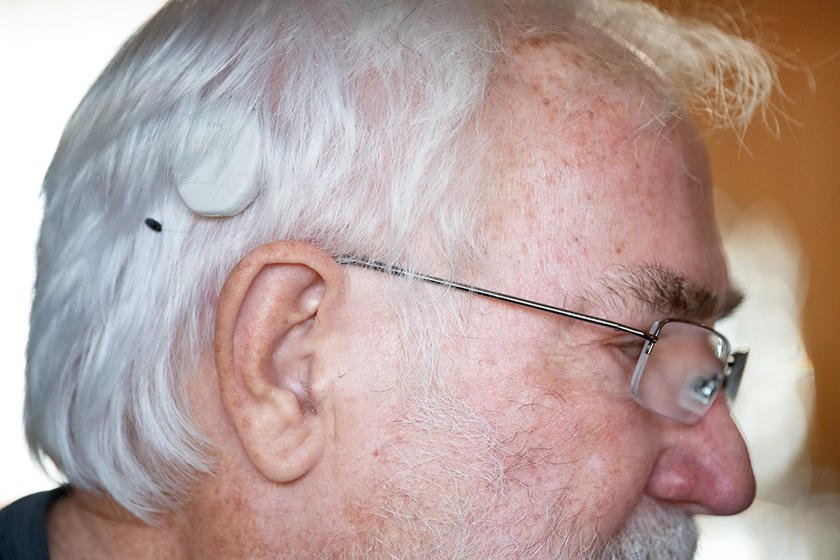 a cochlear implant sound processor clip into a man's hair