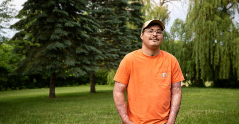 James Rogers, a former patient at the University of Iowa Burn Treatment Center, standing outdoors