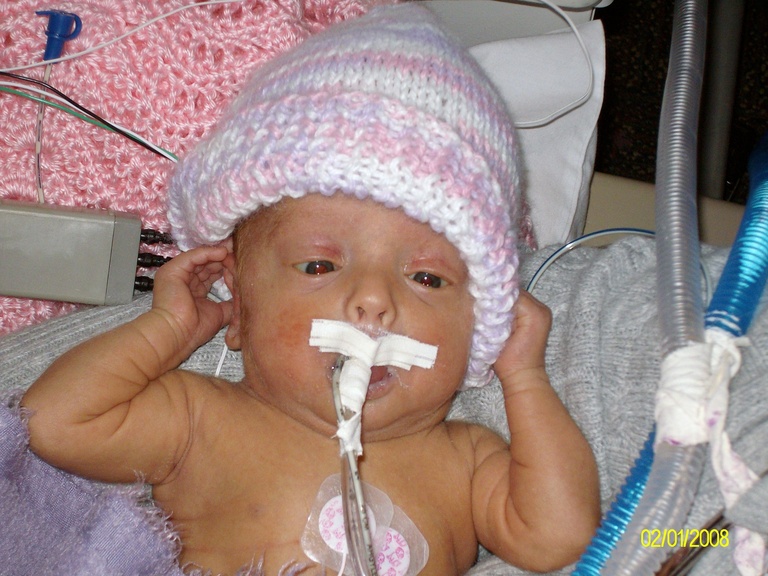 A baby with tubes running through their body