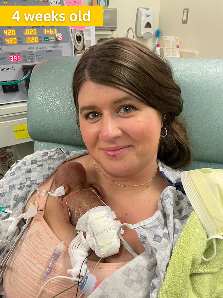 Nash at 4 weeks old, with his mom