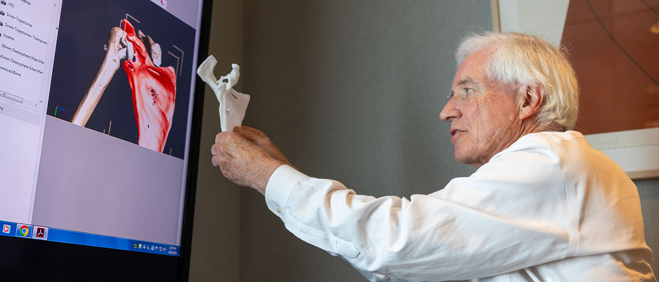 A man holding an implant up to an x-ray 