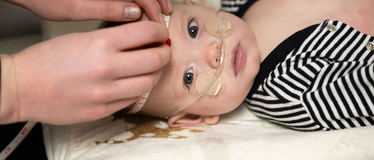 A baby with a tube in their nose