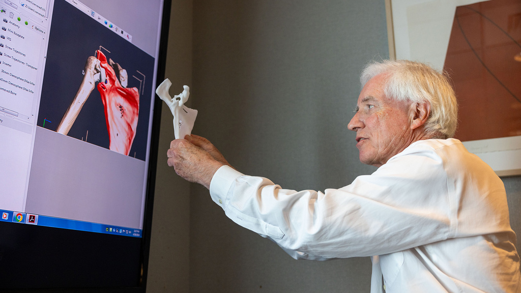 A man holding an implant up to an x-ray
