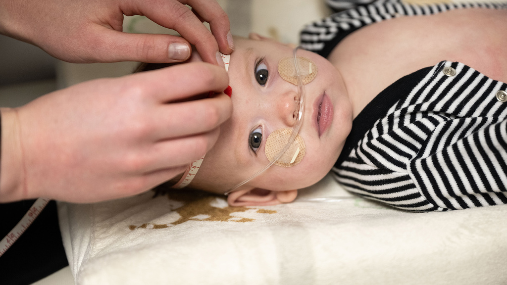 A baby with a tube in their nose